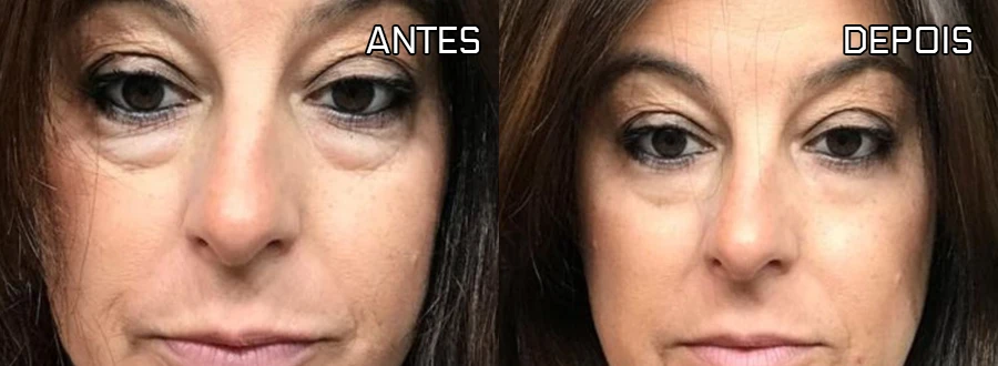 Resultado
