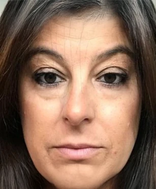 Depoimento
