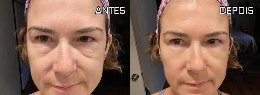 Resultado