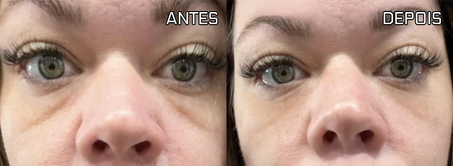Resultado